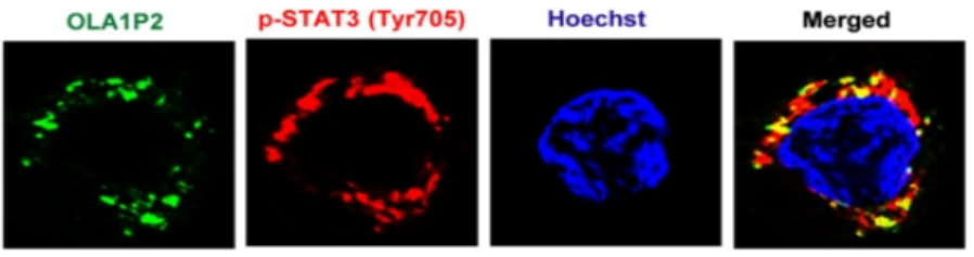 1508141498746023075.png RNA-蛋白FISH結(jié)果圖.png